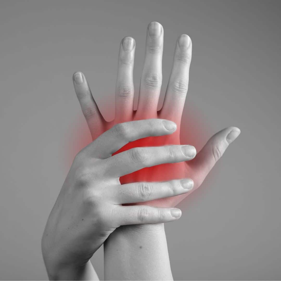 Carpal tunnel syndrome