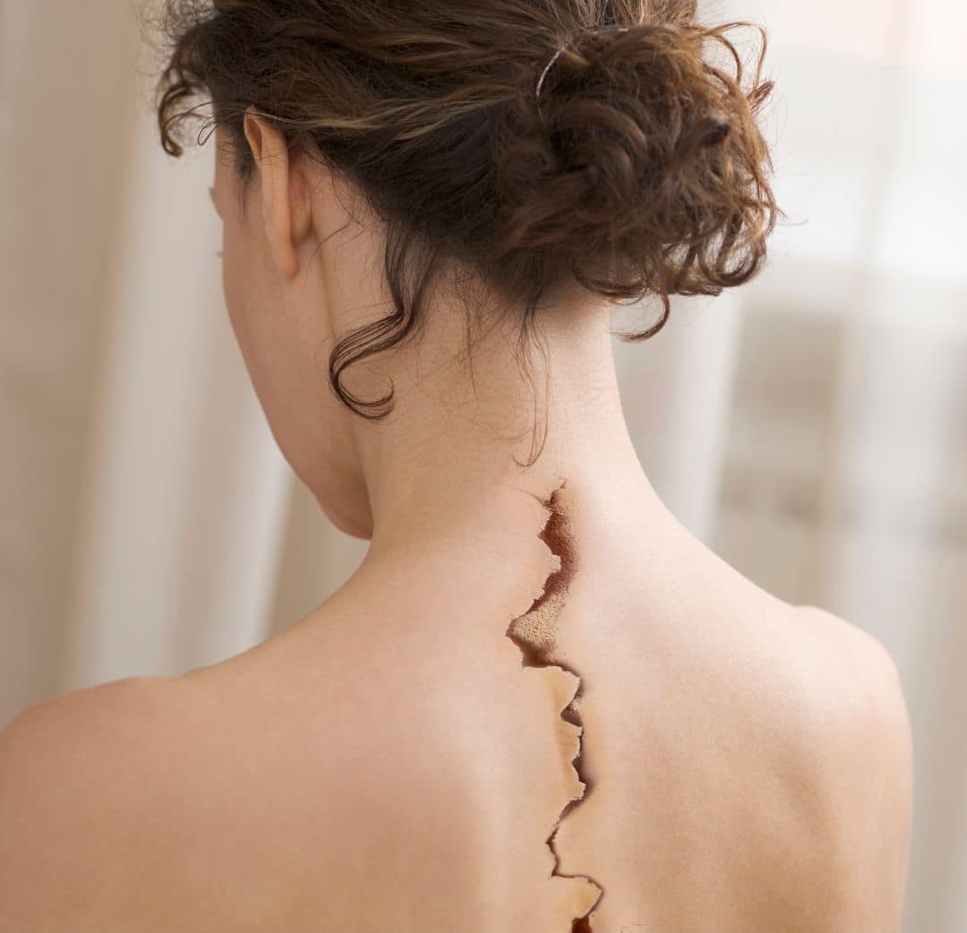 Osteopathy - more than cracking